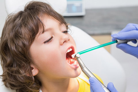 عوامل مؤثر بر ایجاد پوسیدگی دندان