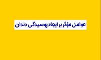 پویش سلامت دهان و دندان؛ عوامل موثر بر ایجاد پوسیدگی دندان