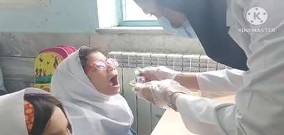 آغاز طرح وارنیش فلورایدتراپی در مدارس استان